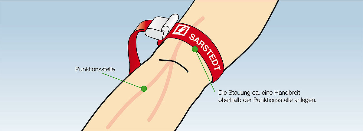 Venenstaubinde, vom Patienten weg gespannt, Arm leicht transparent, Vene sichtbar, aufzeigen der Punktionsstelle, aufzeigen der Stauung