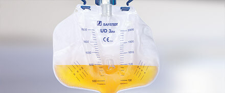 Bild eines mit Urin gefüllten UD 3 plus Urindrainage-System