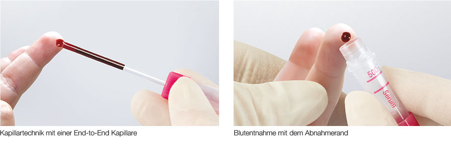 zwei geteiltes Bild, links kapillare Blutentnahme mithilfe einer End-to-End Kapillare, links kapillare Blutentnahme mit dem Abnahmerand